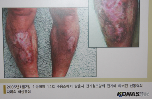 ¡°ºÏÇÑ ±³È¼Ò, Àΰ£ Á¸¾ö¼º À§ÇÑ ÃÖ¼ÒÇÑ Ã³..